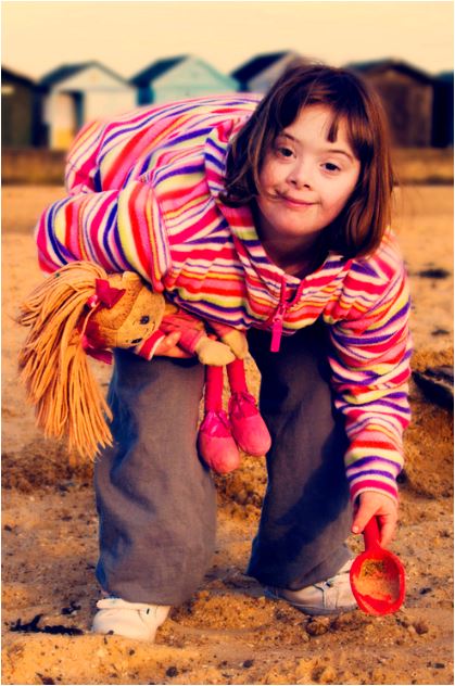 downsyndrome2