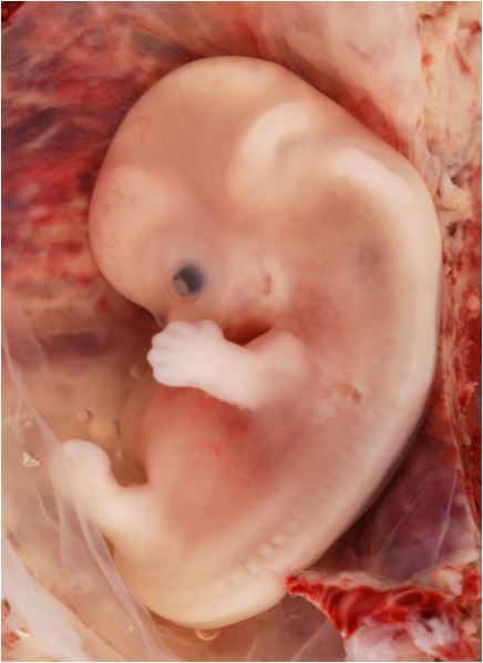 embryo